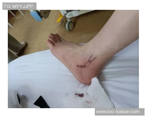 米体报道S希门尼斯考虑右脚踝手术决定将在未来几天做出